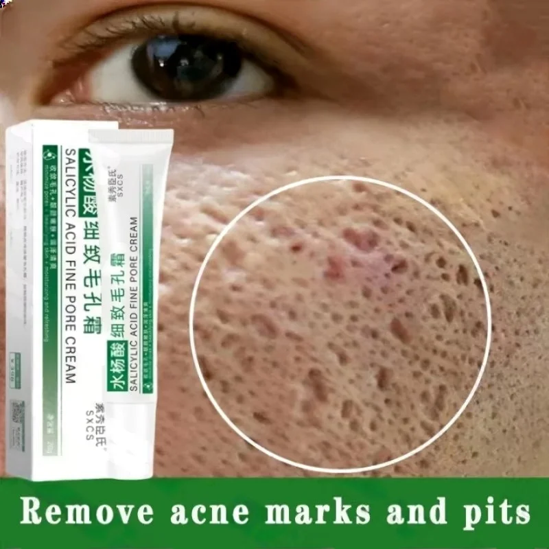 살리실산 모공 클리어링 크림 모공 축소 블랙헤드 제거  - Korean Skincare Routine 리뷰 및 가격