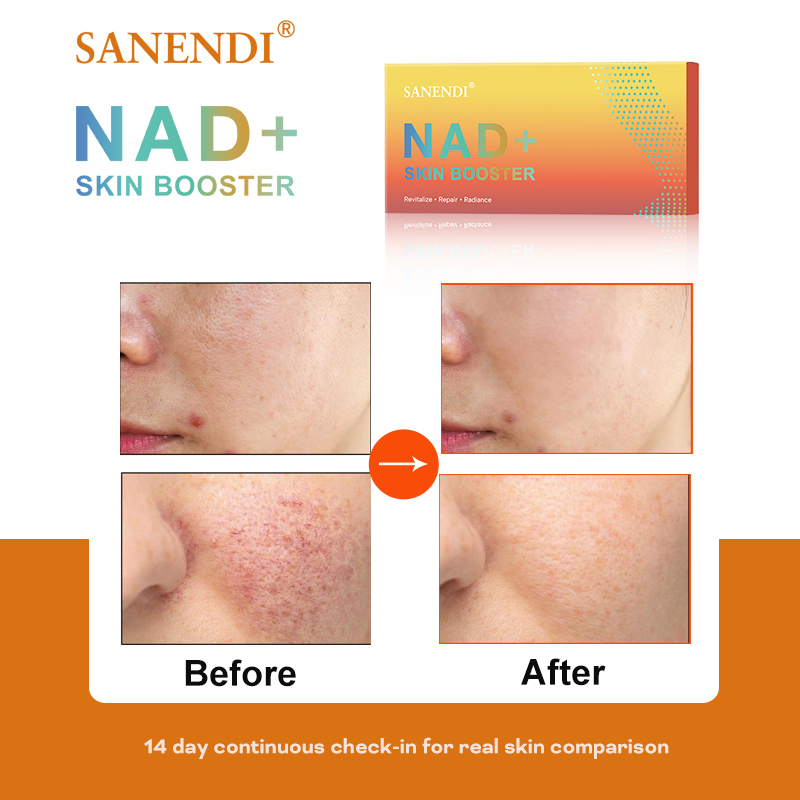 산엔디 NAD+ 한국 스킨케어 제품 복합 에센스 가벼운 - Korean Skincare Routine 리뷰 및 가격
